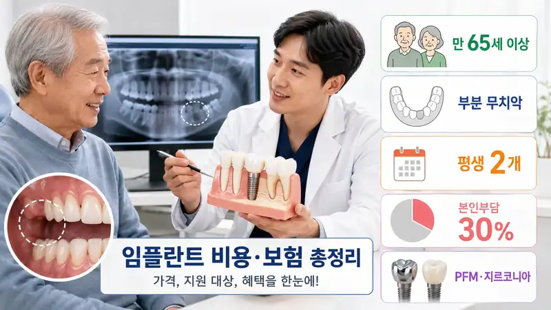 2026 임플란트 가격·건강보험 지원 대상, 65세 이상 비용은 얼마?
